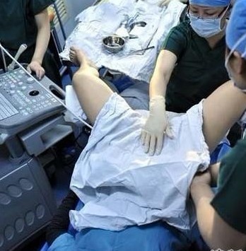 2022年北京赠卵供卵试管婴儿医院排名，北航医院和协和医院榜上有名