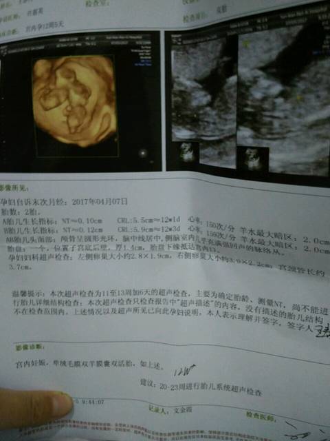 漳州哪家医院可以做供卵试管医院？成功率有多高？