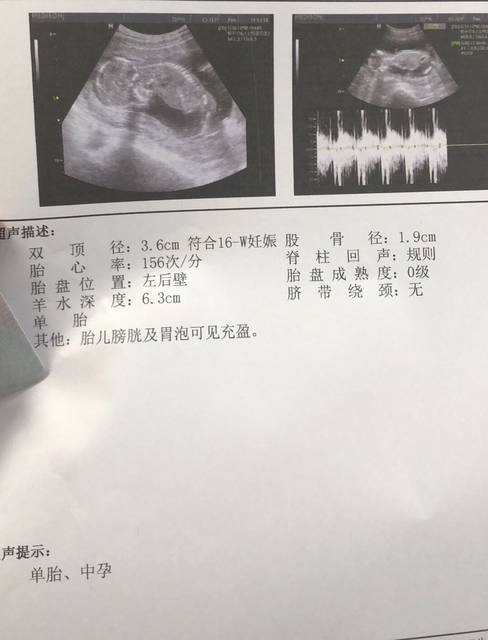 年龄对供卵试管婴儿成功率的影响