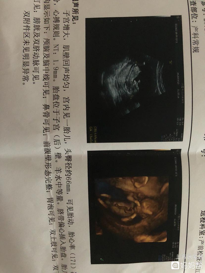 赠卵试管加热液体的正确操作