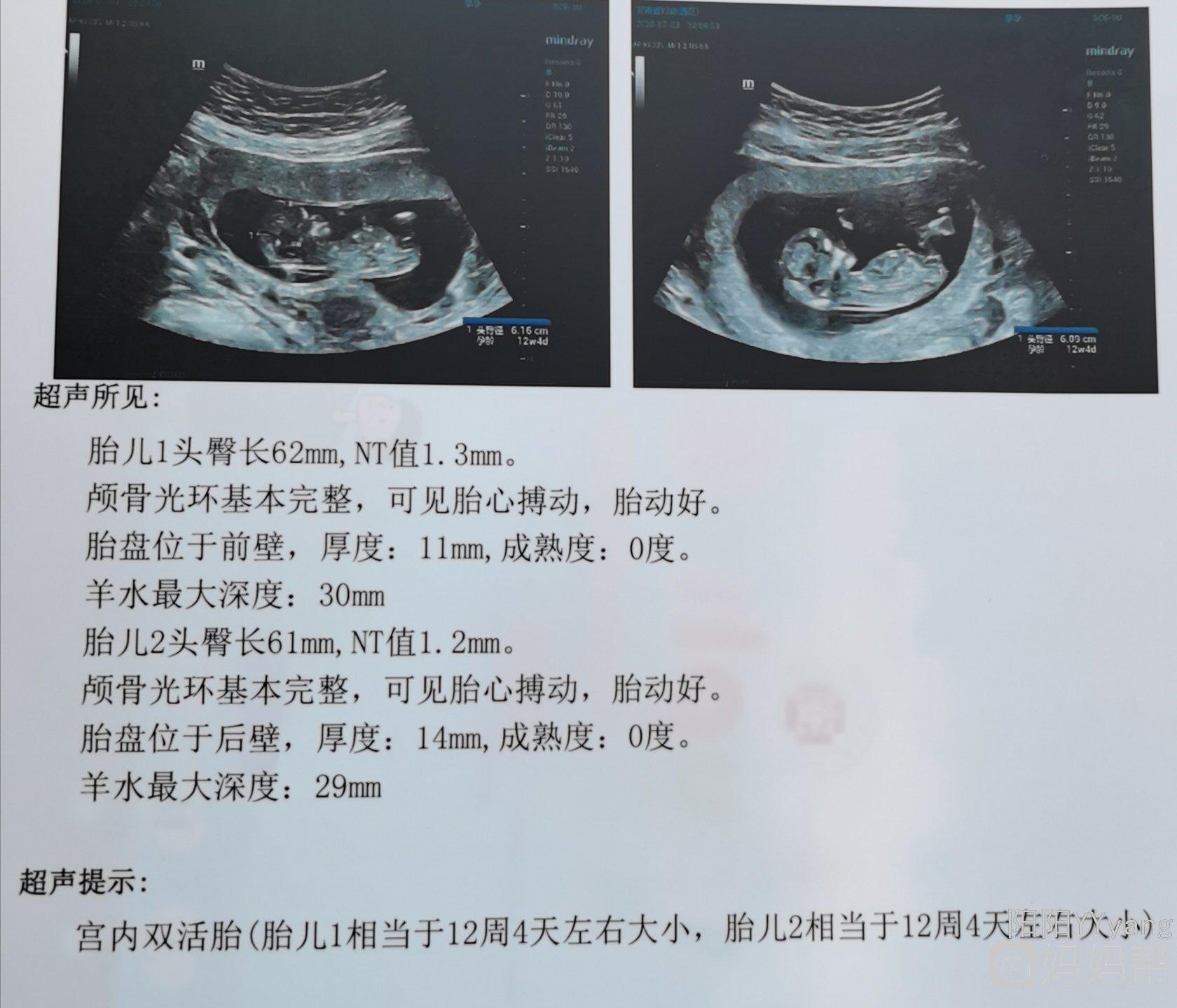 借卵做试管婴儿的是什么专业