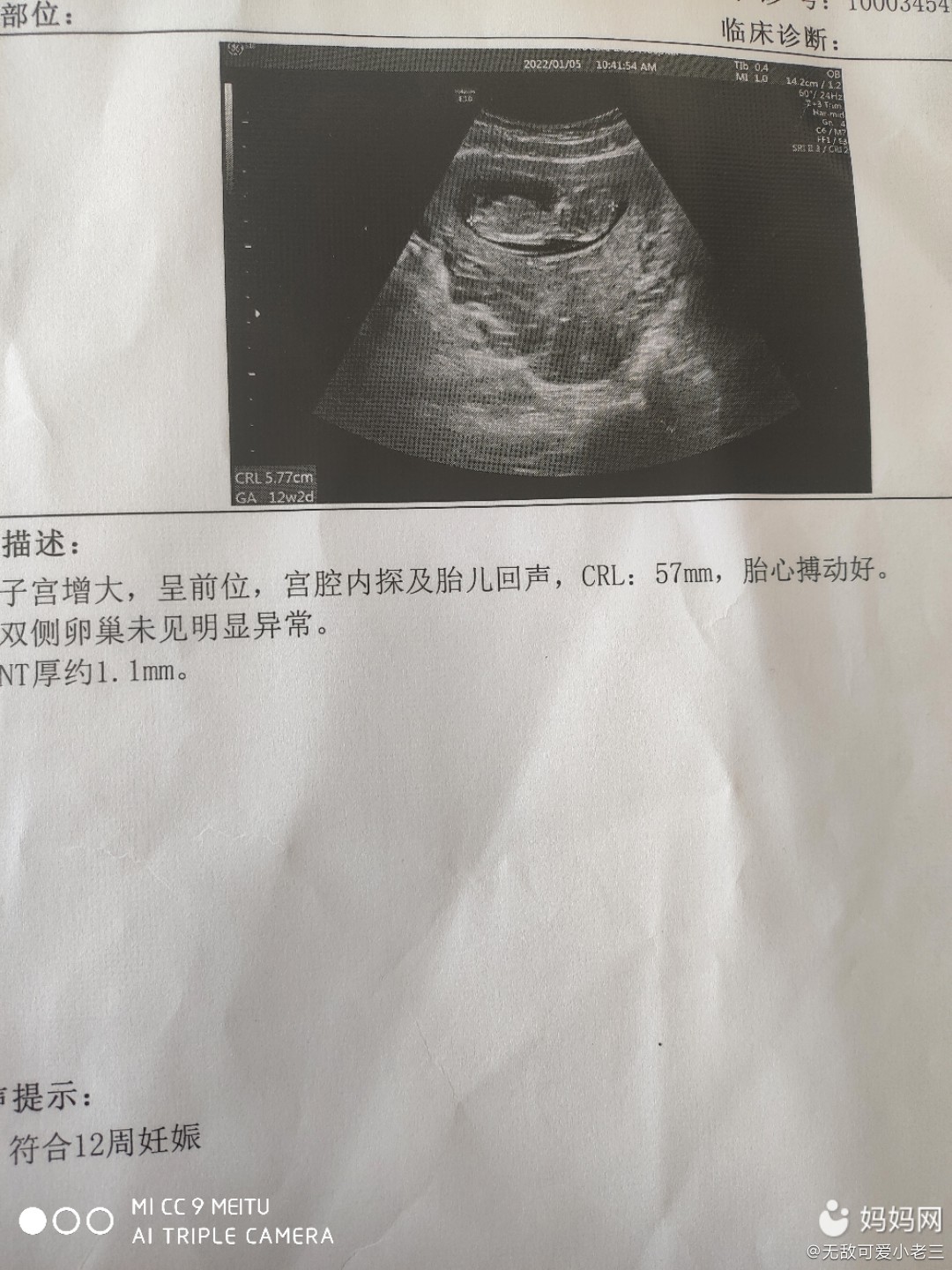 借卵做试管婴儿的是什么专业