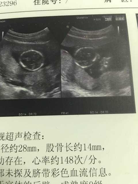 试管婴儿生儿子服务价格