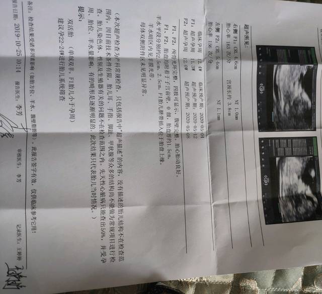 内膜异位试管容易成功