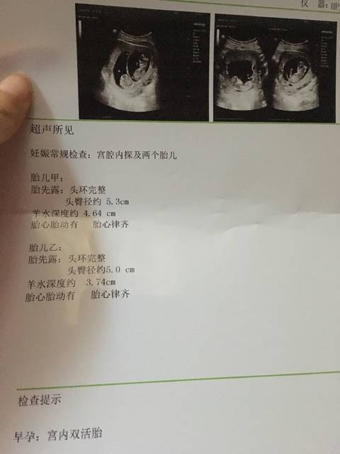 江苏南通试管代怀包成功总费用期间适当运动的益处你知道吗？