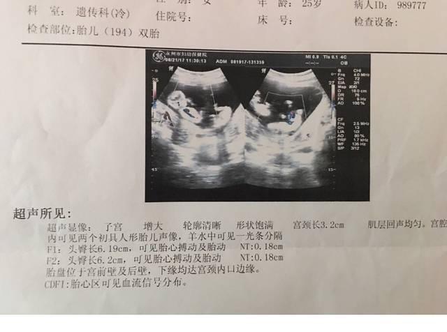 南通锦江妇幼代怀包生儿子多少钱？