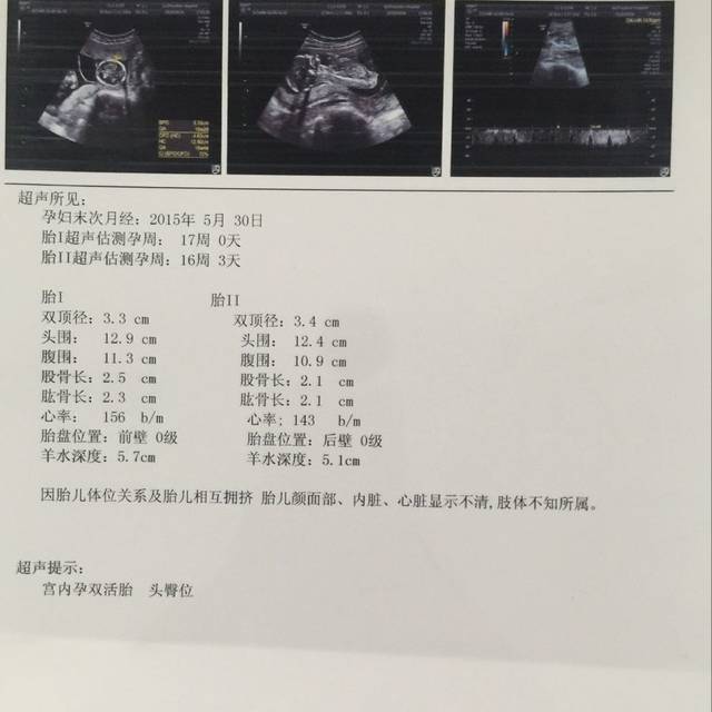 试管促排移植后剩余的胚胎医院会怎么处理？