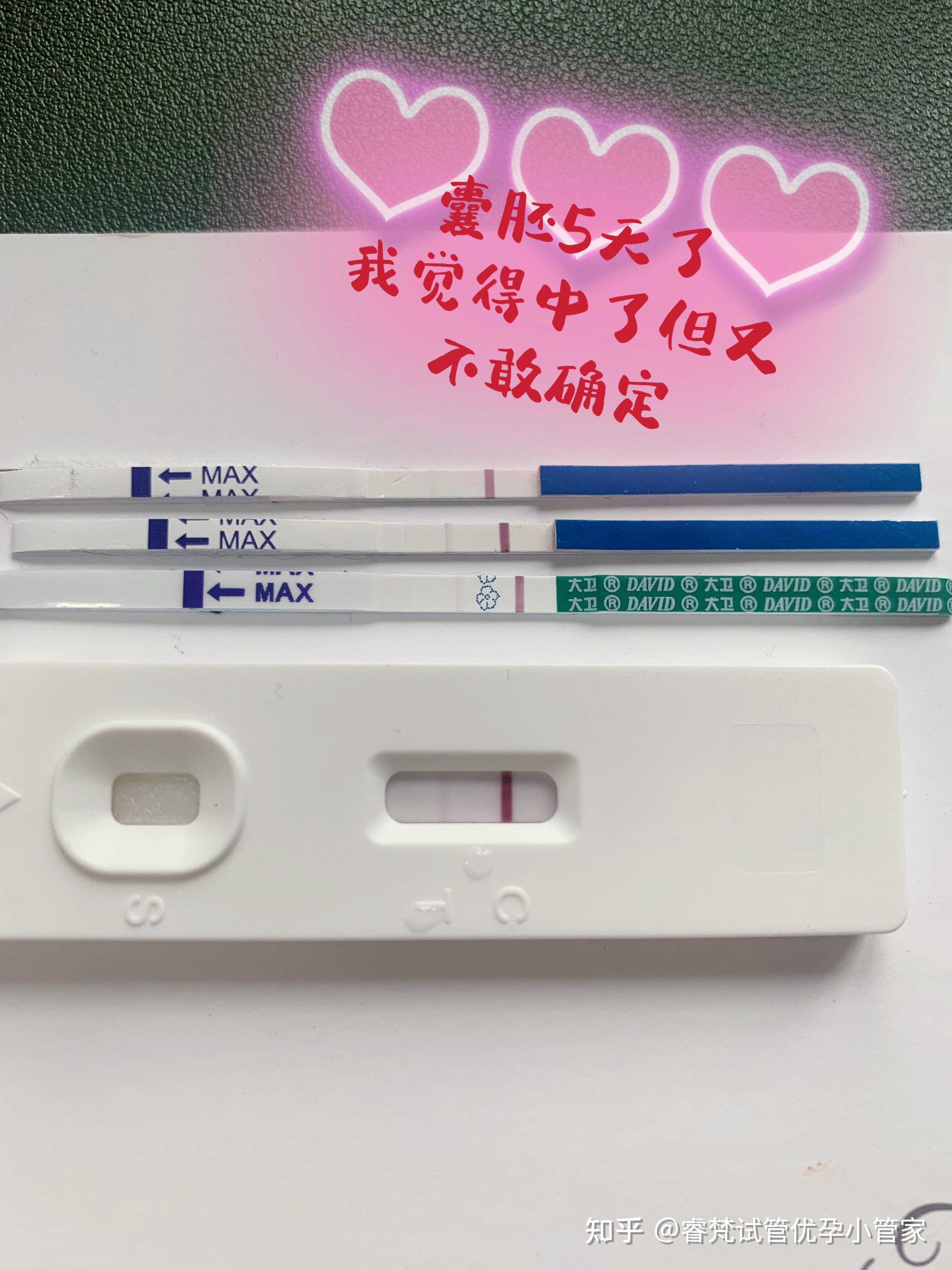 有没有试管长方案一次成功的