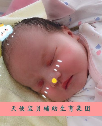2024年农村户口代生医院可以补助3万是真的吗