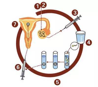 做试管供卵助孕公司对年纪有没有要求+做选择性别试管公司对女性子宫有何要求